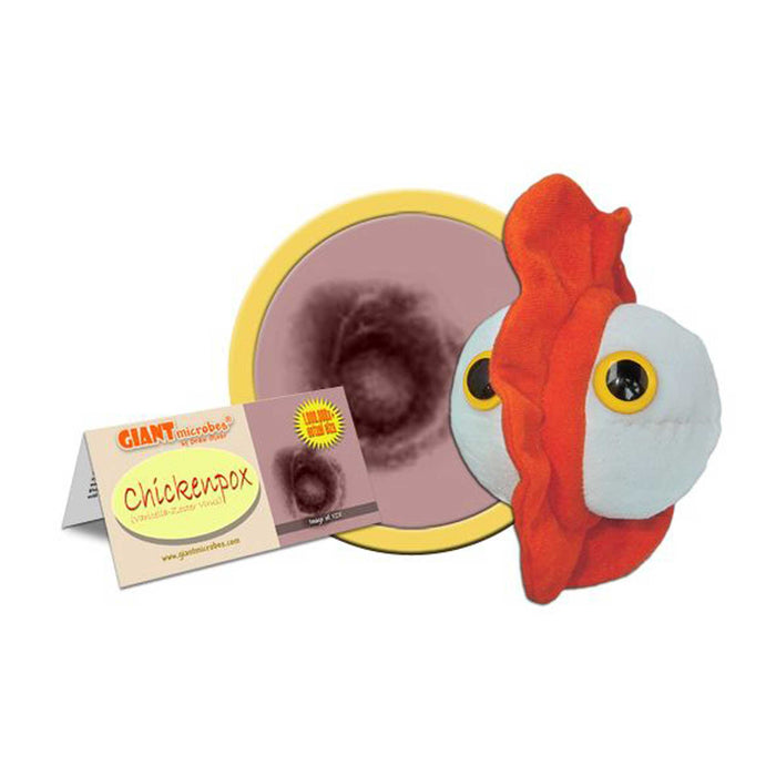 Giant Microbe | Chicken Pox